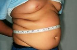 Ожирение у детей: причины развития, возможные последствия